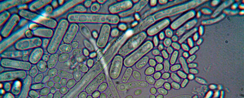 Biofilm de placa bacteriana